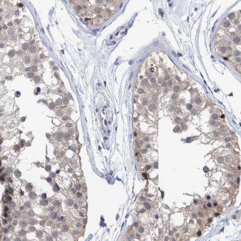 Immunohistochemistry-Paraffin PURL Antibody - BSA Free