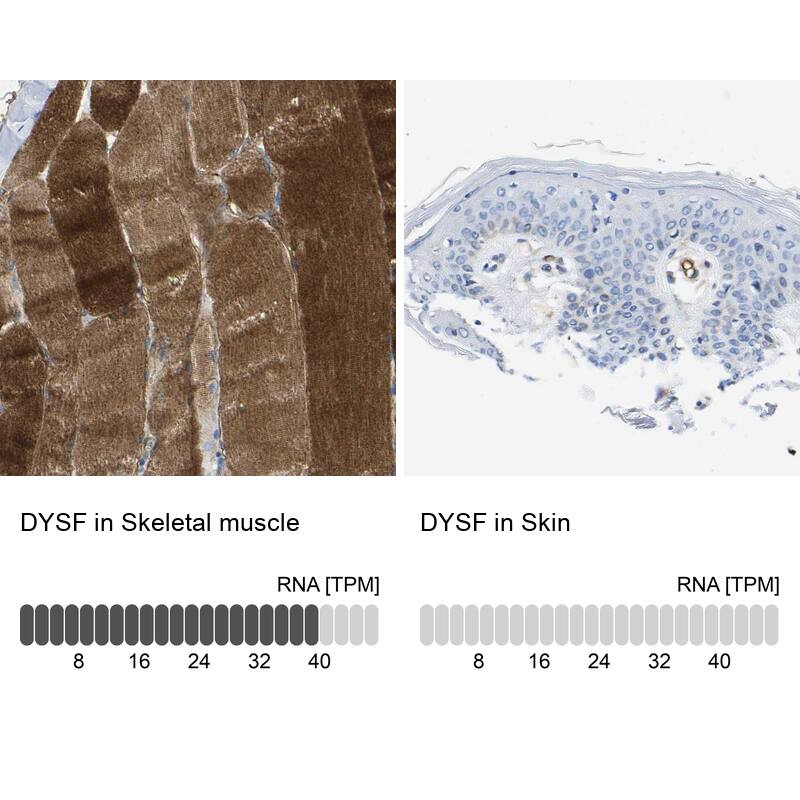 <b>Orthogonal Strategies Validation. </b>Analysis in human skeletal muscle and skin tissues. Corresponding RNA-seq data are presented for the same tissues.