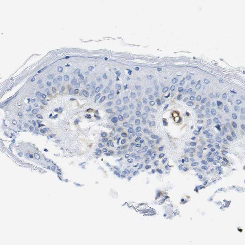 Staining of human skin shows no positivity in squamous epithelial cells as expected.