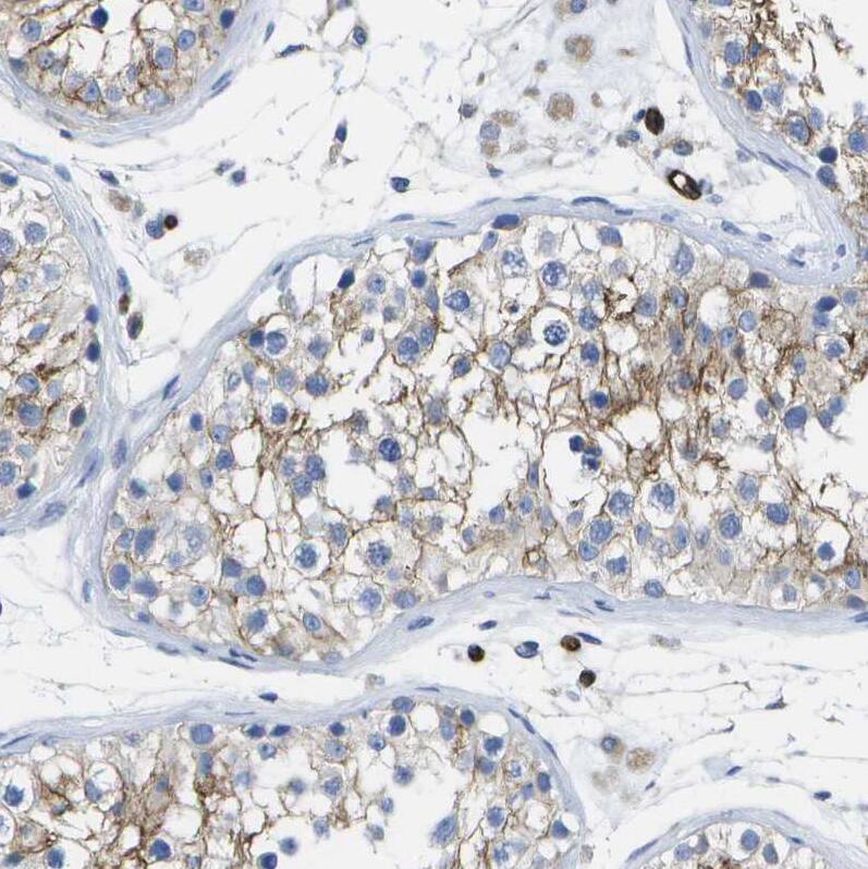 Staining of human testis shows moderate membranous positivity in cells in seminiferous ducts.