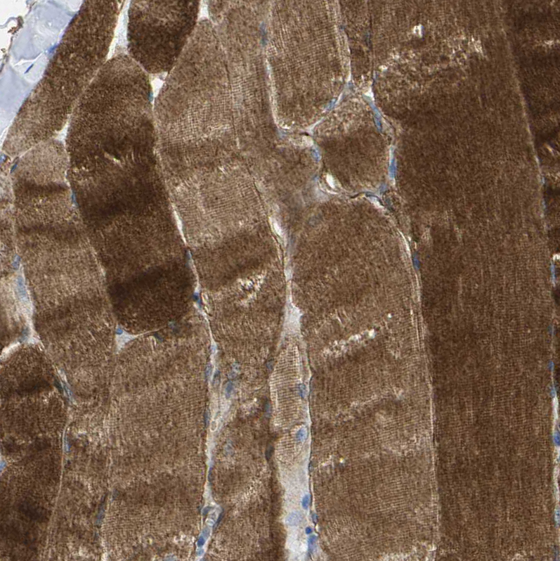 Staining of human skeletal muscle shows  strong cytoplasmic and membranous positivity in myocytes.