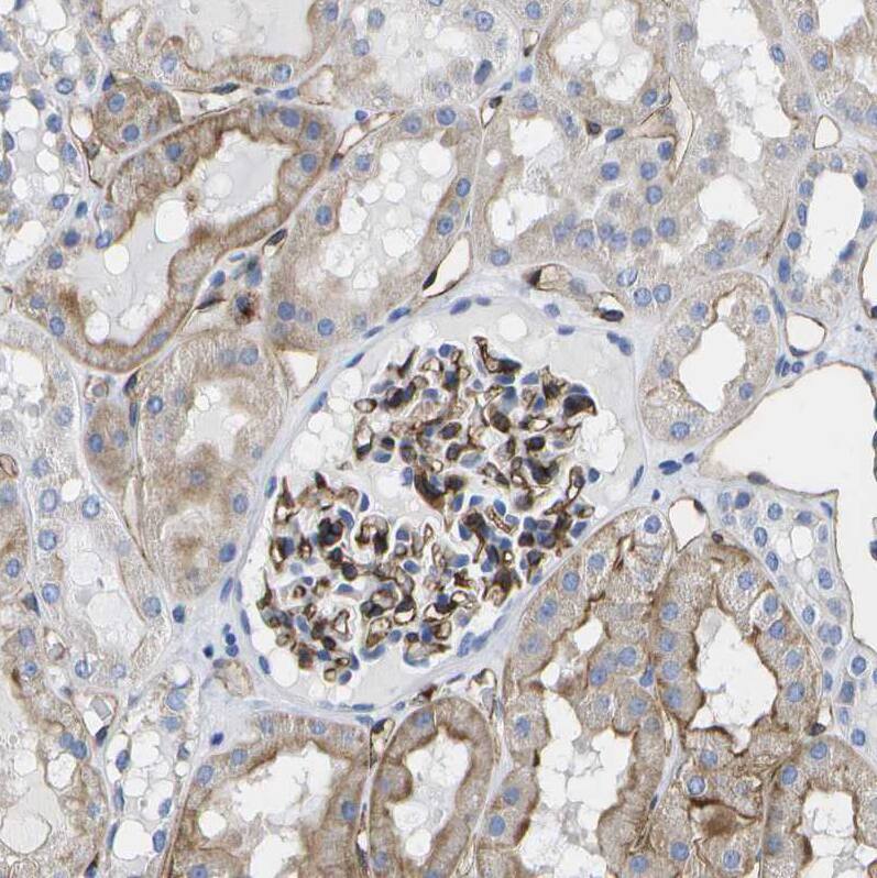 Staining of human kidney shows moderate to strong membranous positivity in cells in glomeruli and cells in tubules.