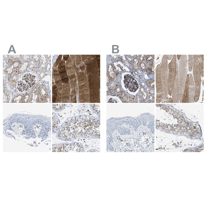 <b>Orthogonal Strategies Validation. </b>Staining of human kidney, skeletal muscle, skin and testis HPA017071 (A) shows similar protein distribution across tissues to independent antibody HPA021945 (B).