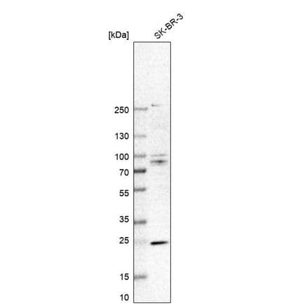 Analysis in human cell line SK-BR-3.