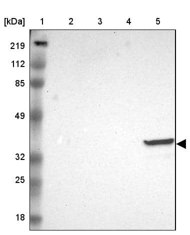 Lane 1: Marker [kDa] 219, 112, 85, 49, 32, 25, 18Lane 2: Human cell line RT-4Lane 3: Human cell line U-251MG spLane 4: Human cell line A-431Lane 5: Human liver tissue