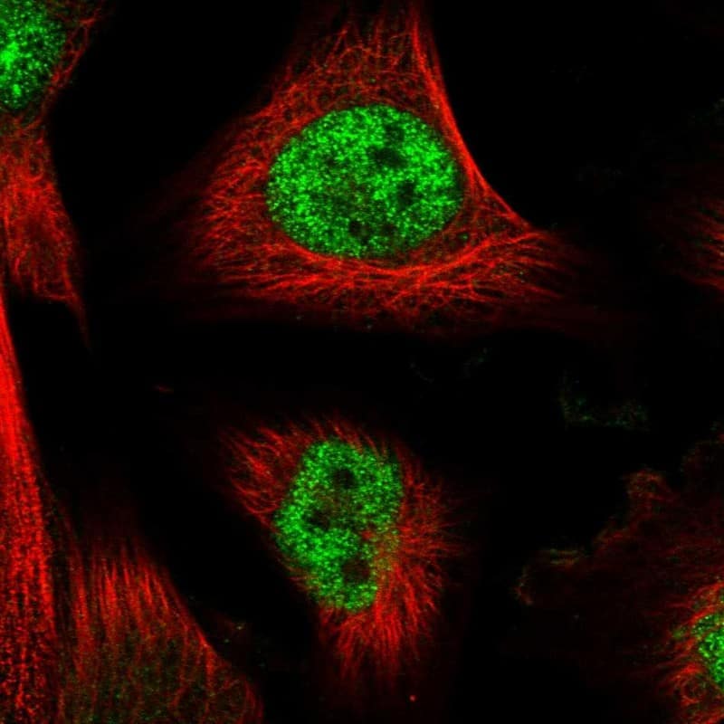 Staining of human cell line U-251 MG shows localization to nucleoplasm.
