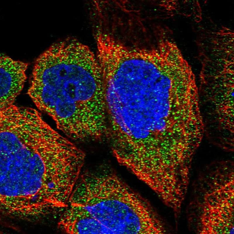 Staining of human cell line A-431 shows localization to cytosol.