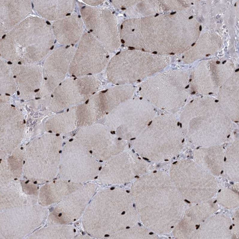 Immunohistochemistry-Paraffin WBP4 Antibody - BSA Free