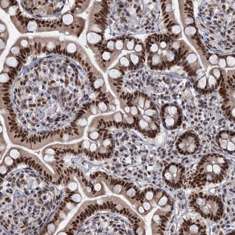Staining of human small intestine shows strong nuclear positivity in glandular cells.