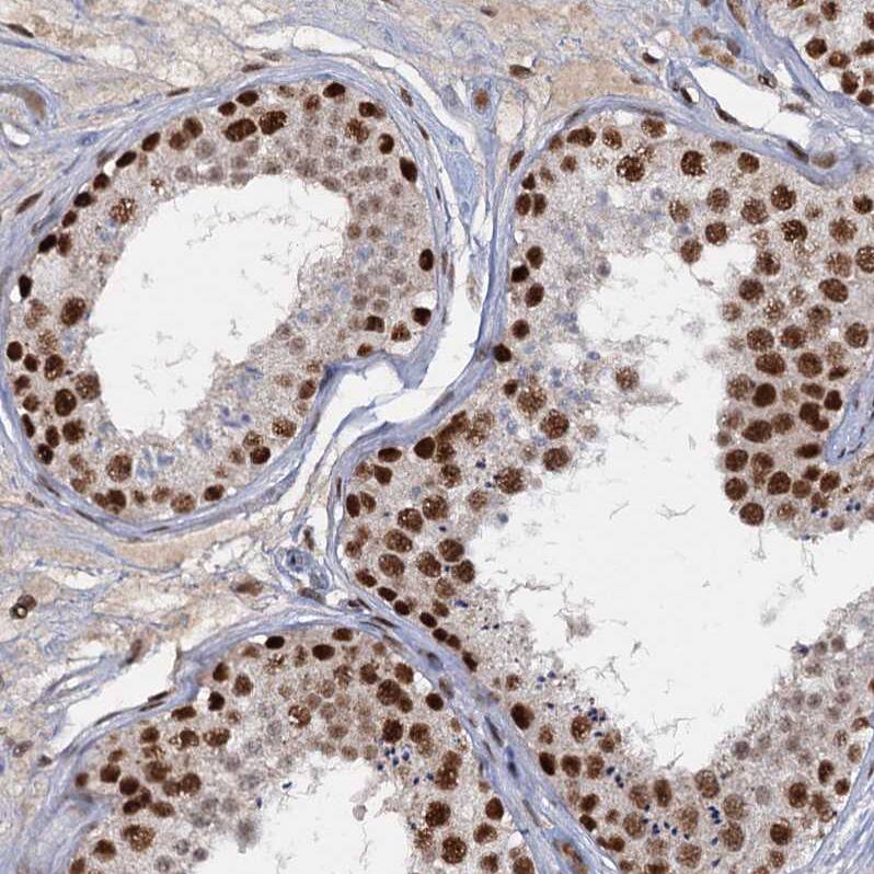Staining of human testis shows strong nuclear positivity in cells in seminiferous ducts.