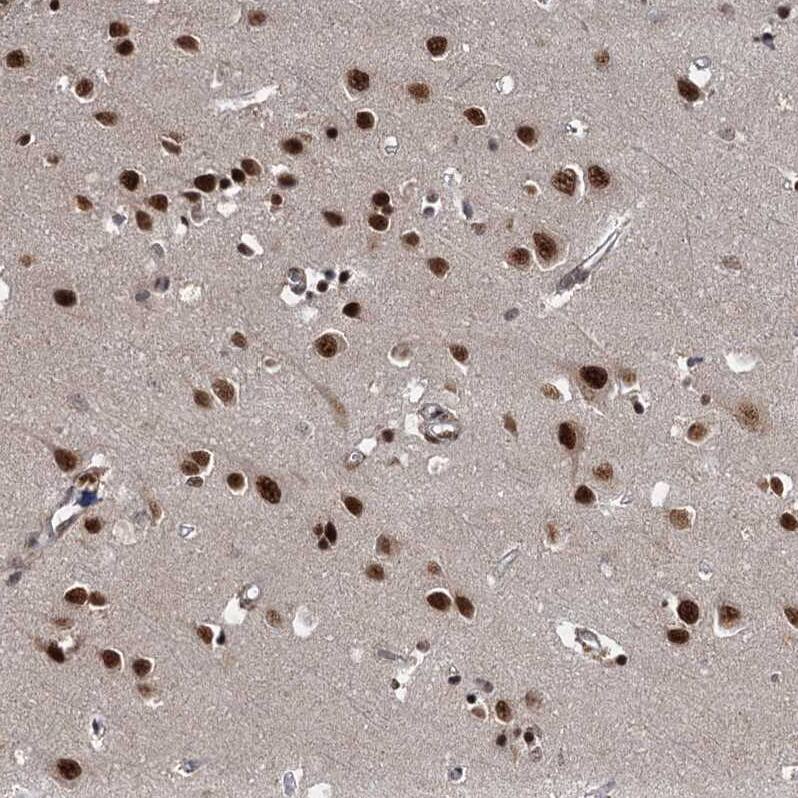 Staining of human cerebral cortex shows strong nuclear positivity in neuronal cells.