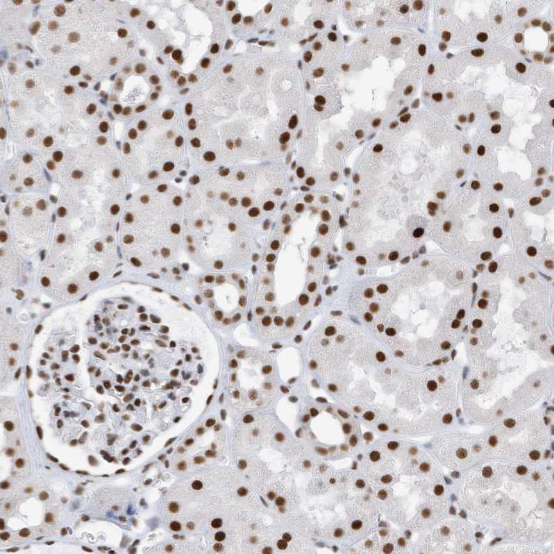 Immunohistochemistry-Paraffin KHSRP Antibody - BSA Free