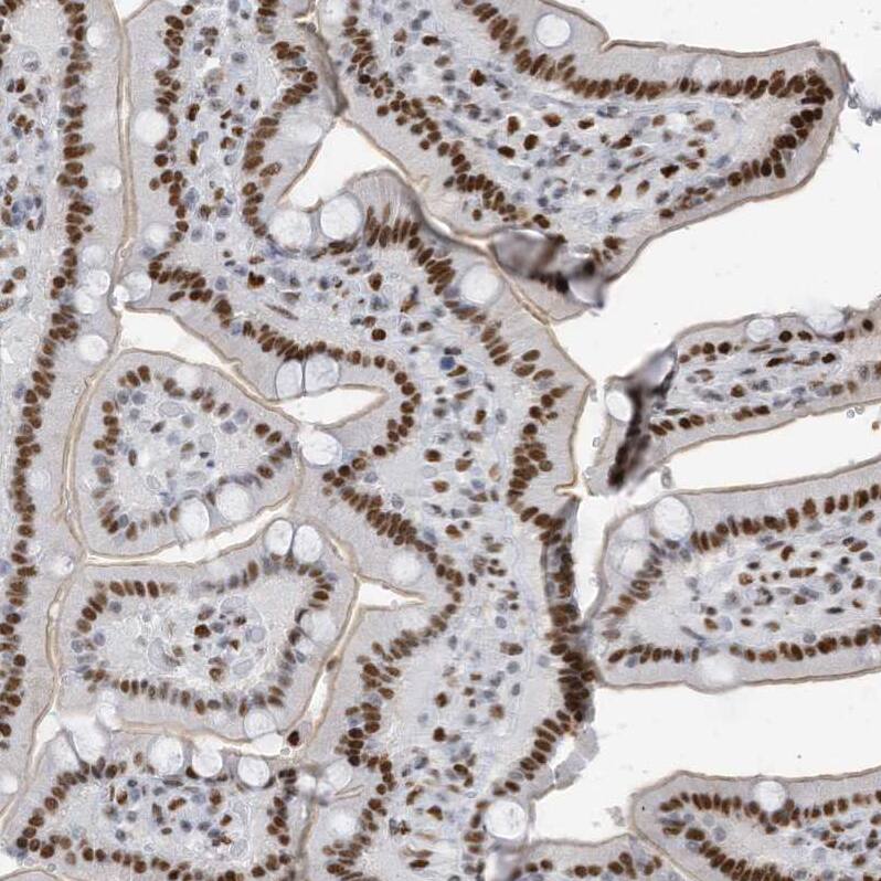 Immunohistochemistry-Paraffin KHSRP Antibody - BSA Free