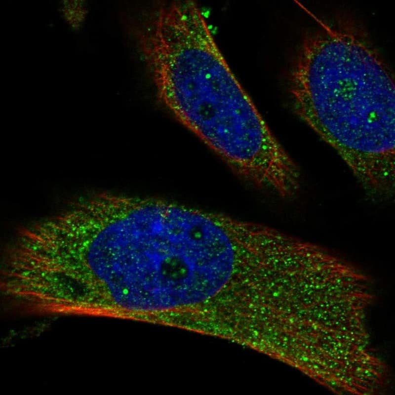 Staining of human cell line U-251 MG shows localization to vesicles.