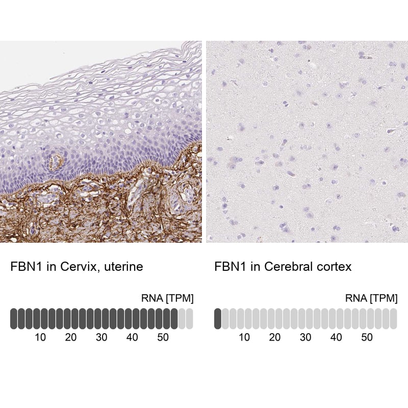 <b>Orthogonal Strategies Validation. </b>Analysis in human cervix, uterine and cerebral cortex tissues using HPA021057 antibody. Corresponding FBN1 RNA-seq data are presented for the same tissues.