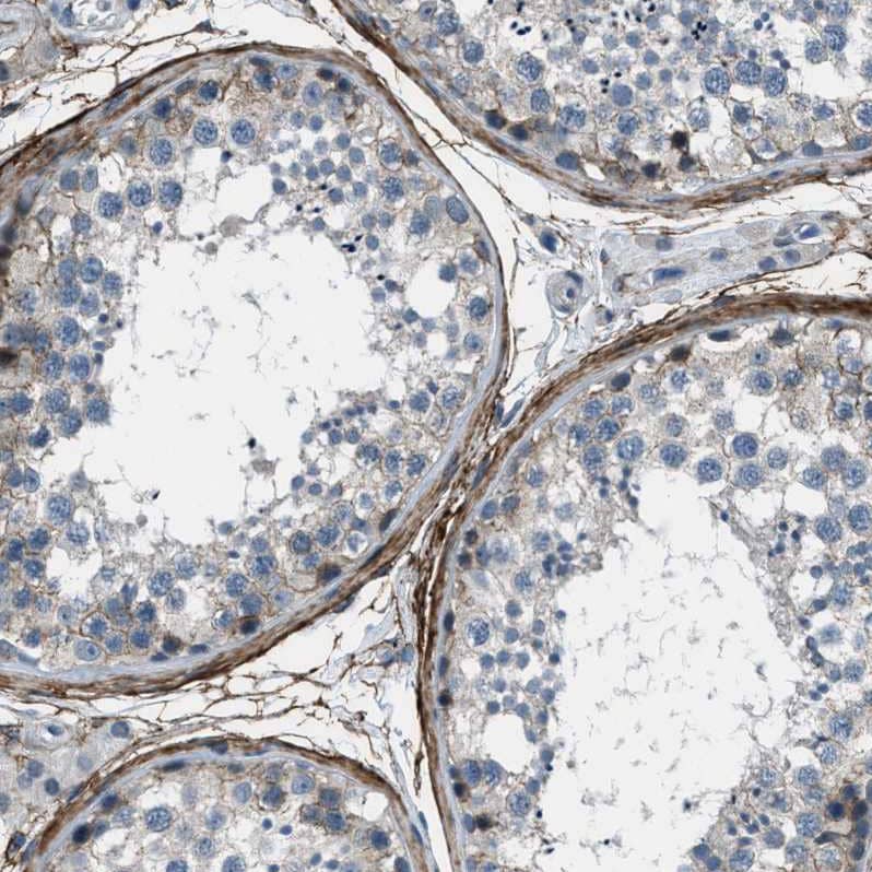 Staining of human testis shows strong membranous positivity in peritubular myoid cells.
