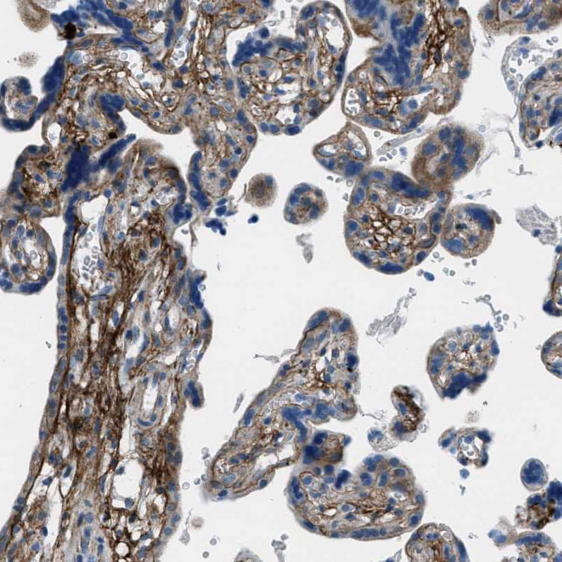 Staining of human placenta shows strong membranous positivity in trophoblastic cells.
