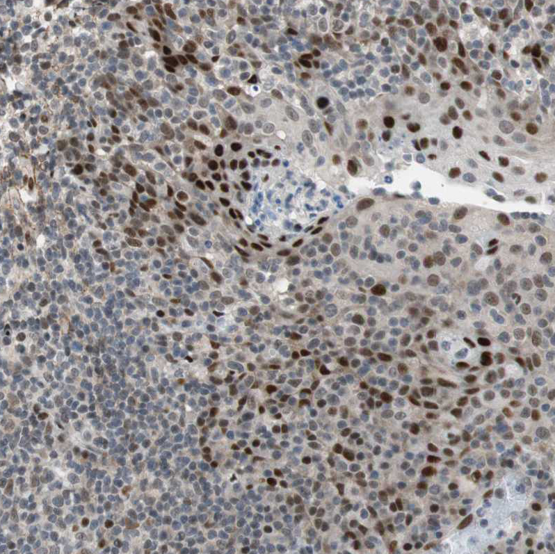 Immunohistochemistry-Paraffin FBXO44 Antibody - BSA Free