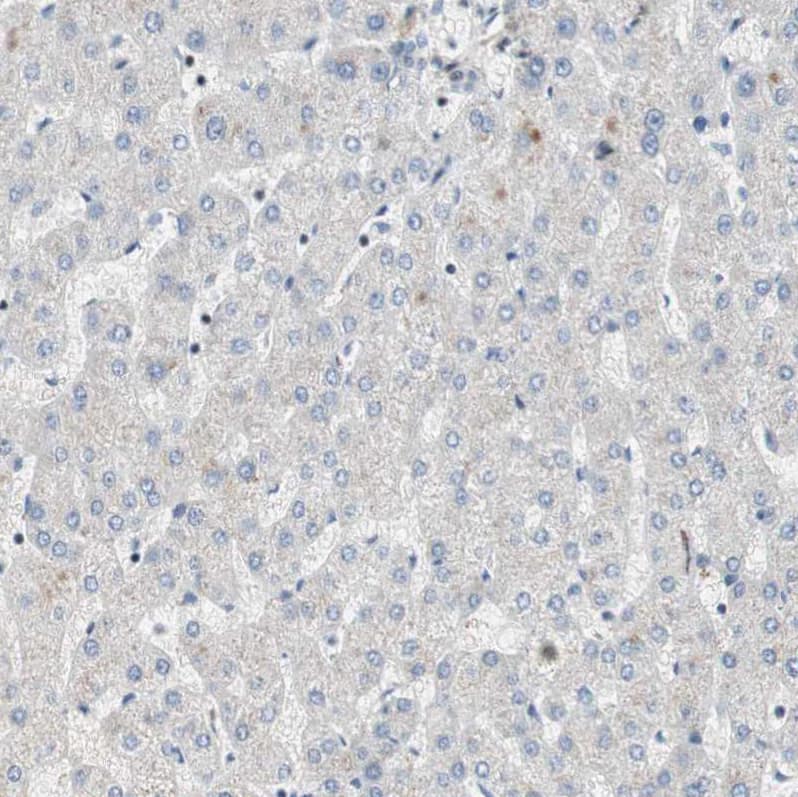 Staining of human liver shows no nuclear positivity in hepatocytes as expected.