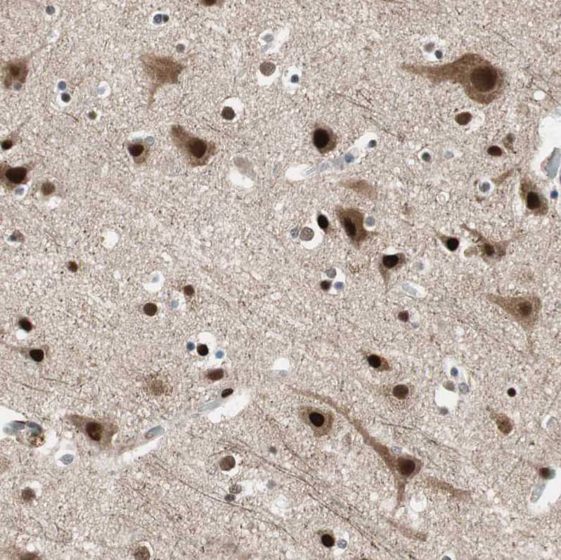 Staining of human brain shows strong nuclear and cytoplasmic positivity in neurons.