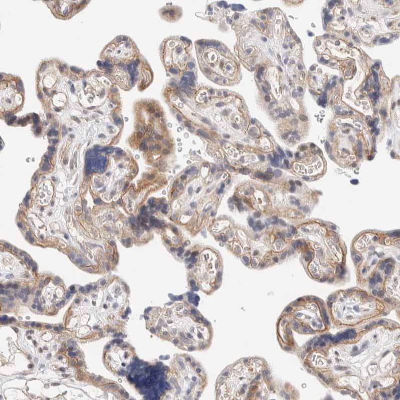 Staining of human placenta shows moderate cytoplasmic positivity in trophoblastic cells.