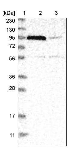Lane 1: Marker [kDa] 230, 130, 95, 72, 56, 36, 28, 17, 11Lane 2: Human cell line RT-4Lane 3: Human cell line U-251MG sp