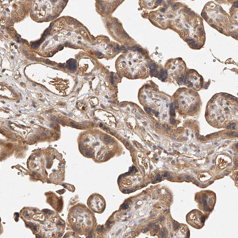 Staining of human placenta shows moderate cytoplasmic positivity in trophoblastic cells.