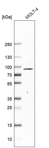 Analysis in human cell line MOLT-4.