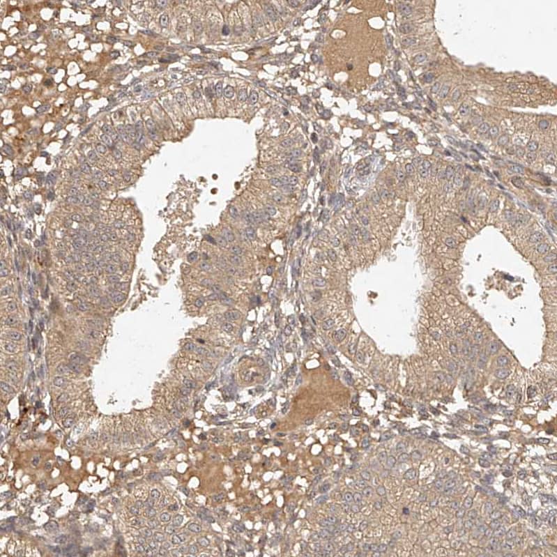Staining of human endometrium shows weak cytoplasmic positivity in glandular cells.