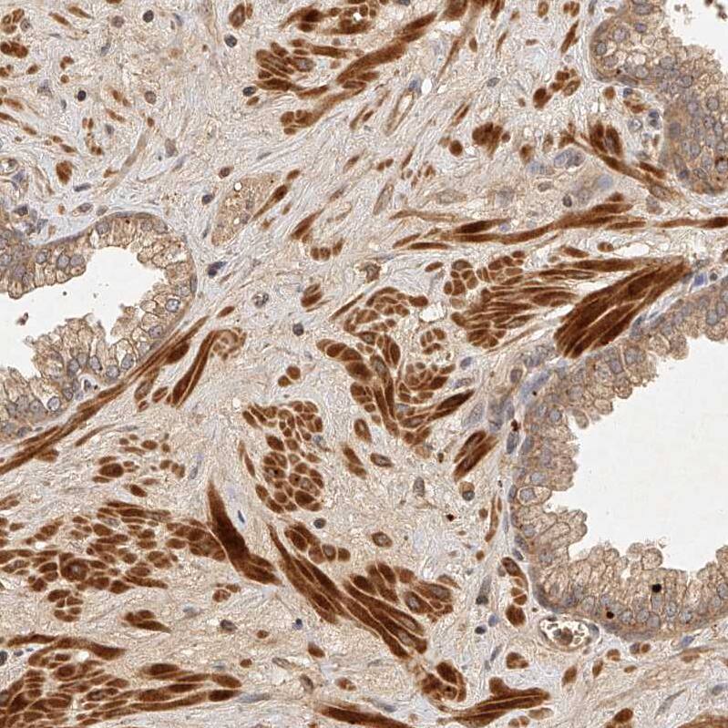 Staining of human prostate shows strong cytoplasmic positivity in smooth muscle cells.