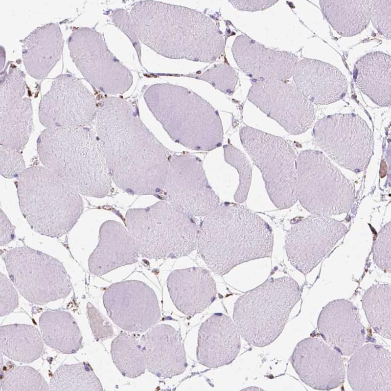 Staining of human skeletal muscle shows very weak cytoplasmic granular positivity in myocytes.