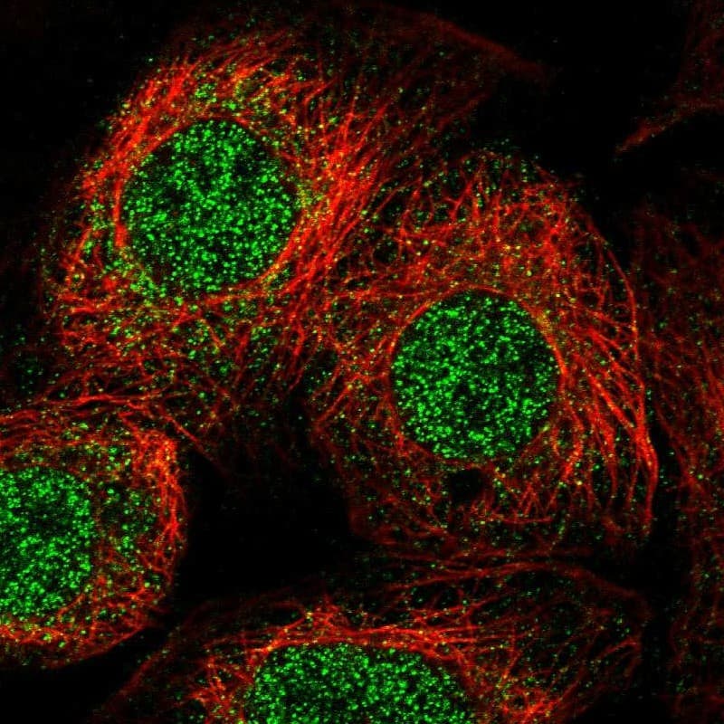 Staining of human cell line A-431 shows localization to nucleoplasm & cytosol.