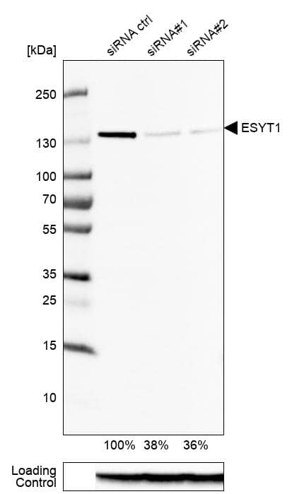 <b>Genetic Strategies Validation. </b>Analysis in U-87MG ATCC cells transfected with control siRNA, target specific siRNA probe #1 and #2, using Anti-ESYT1 antibody. Remaining relative intensity is presented. Loading control: Anti-GAPDH.