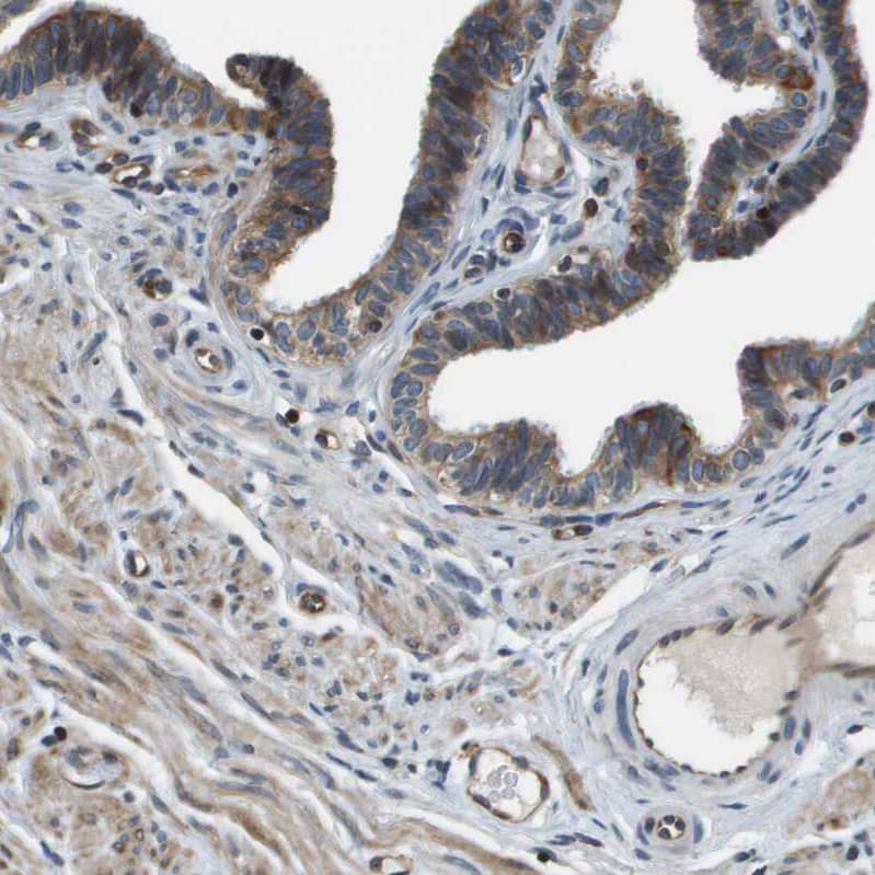 Staining of human fallopian tube shows moderate cytoplasmic positivity in glandular cells and endothelial cells.