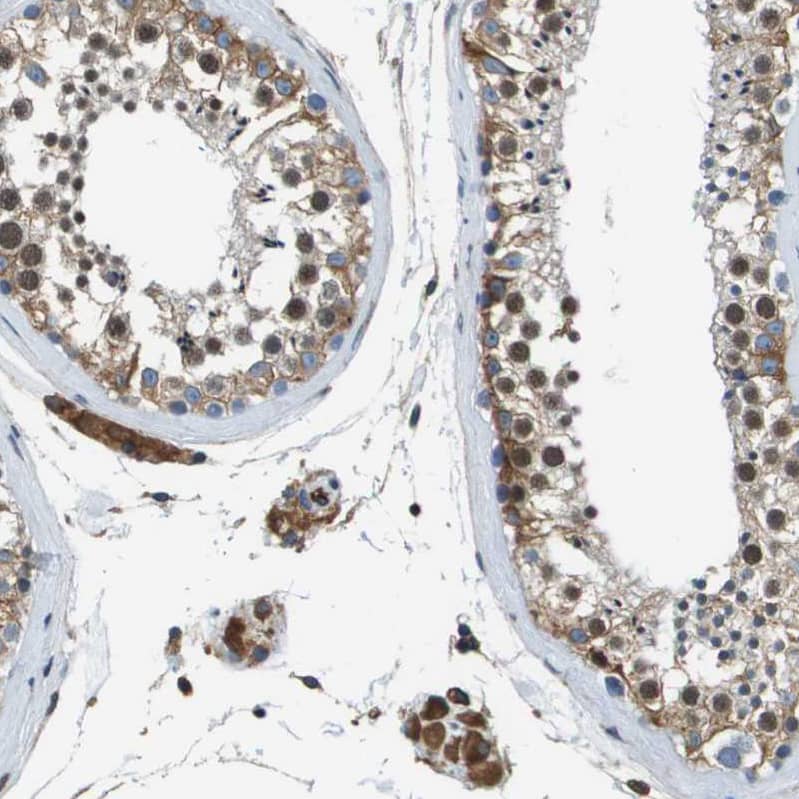 Staining of human testis shows moderate cytoplasmic positivity in cells in seminiferous ducts and leydig cells.