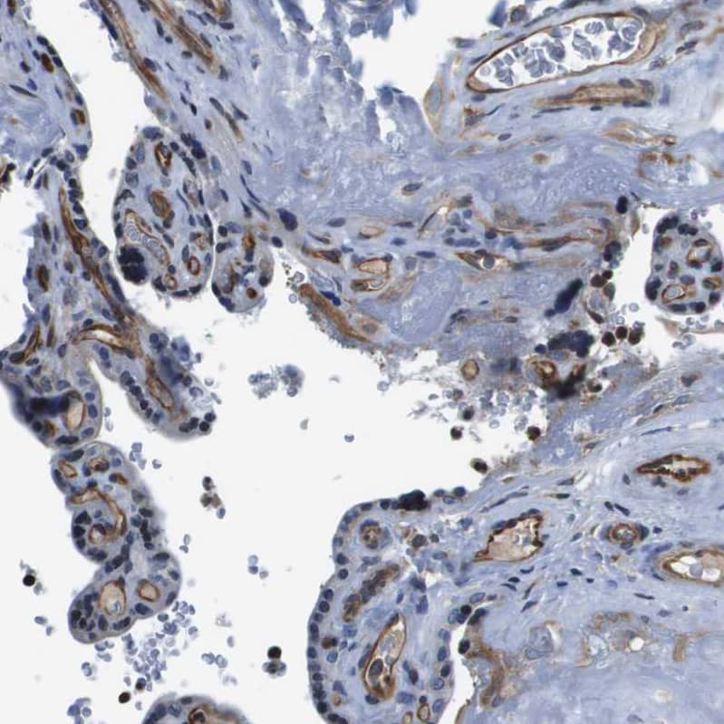 Staining of human placenta shows moderate cytoplasmic positivity in endothelial cells.