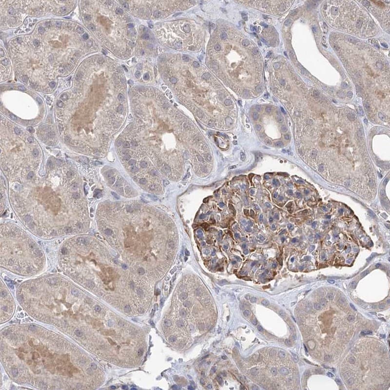 Staining of human kidney shows cytoplasmic positivity in cells in tubules and cells in glomeruli.