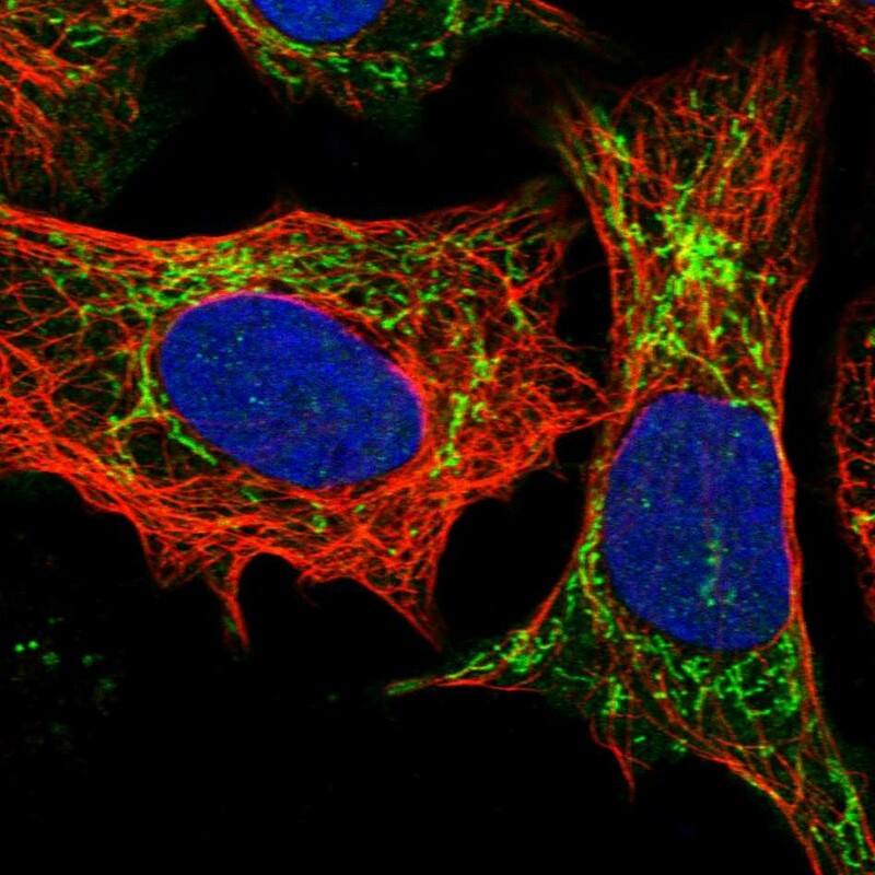 Staining of human cell line U-2 OS shows localization to cytosol & mitochondria.