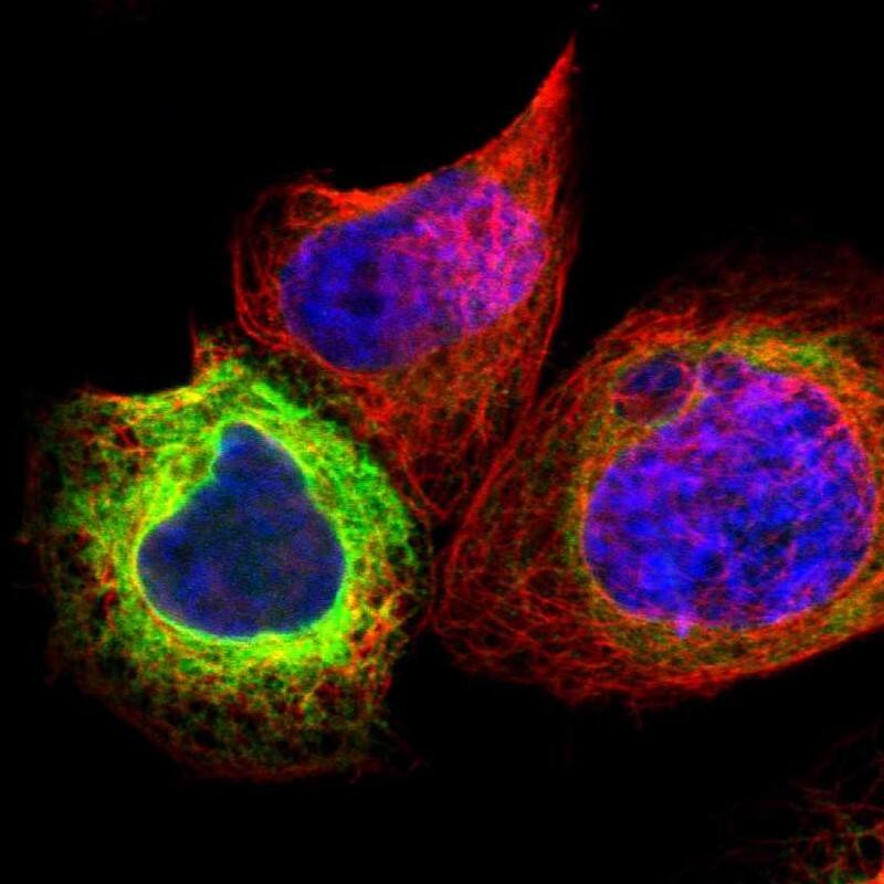 Staining of human cell line A-431 shows localization to endoplasmic reticulum.