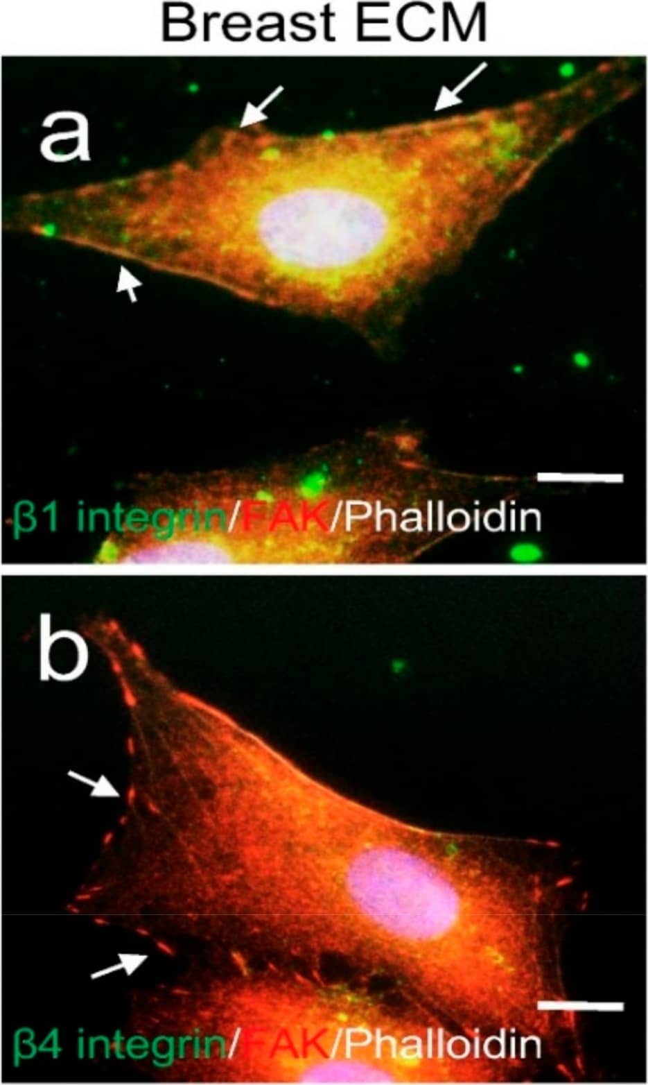 Immunocytochemistry/ Immunofluorescence: FAK Antibody [NBP1-84750] - Membrane surface receptor expression & metabolomic analysis of cells grown on porcine breast fatty tissue ECM hydrogel. Integrin  beta 1 (a) or  beta 4 (b) receptor (green) & FAK (red) expression in MM231 cells cultured on the ECM hydrogel-coated coverslips were assessed by IF. Phalloidin staining (white) of F-actin was used to contour the cells. Scale bars, 10 μm. (c) MS imaging of cross sections of the medium-conditioned blank (upper panels) & MM231 cell culture-laden (bottom panels) hydrogel scaffolds. (d) Examples of ROC (upper) & box-and-whiskers (bottom) plots from the MS imaging analysis, showing data for a compound with m/z 663.024, where differences between the hydrogel samples cultured with or without MM231 cells are clearly evident. Image collected & cropped by CiteAb from the following publication (//pubmed.ncbi.nlm.nih.gov/30257480), licensed under a CC-BY license. Not internally tested by Novus Biologicals.