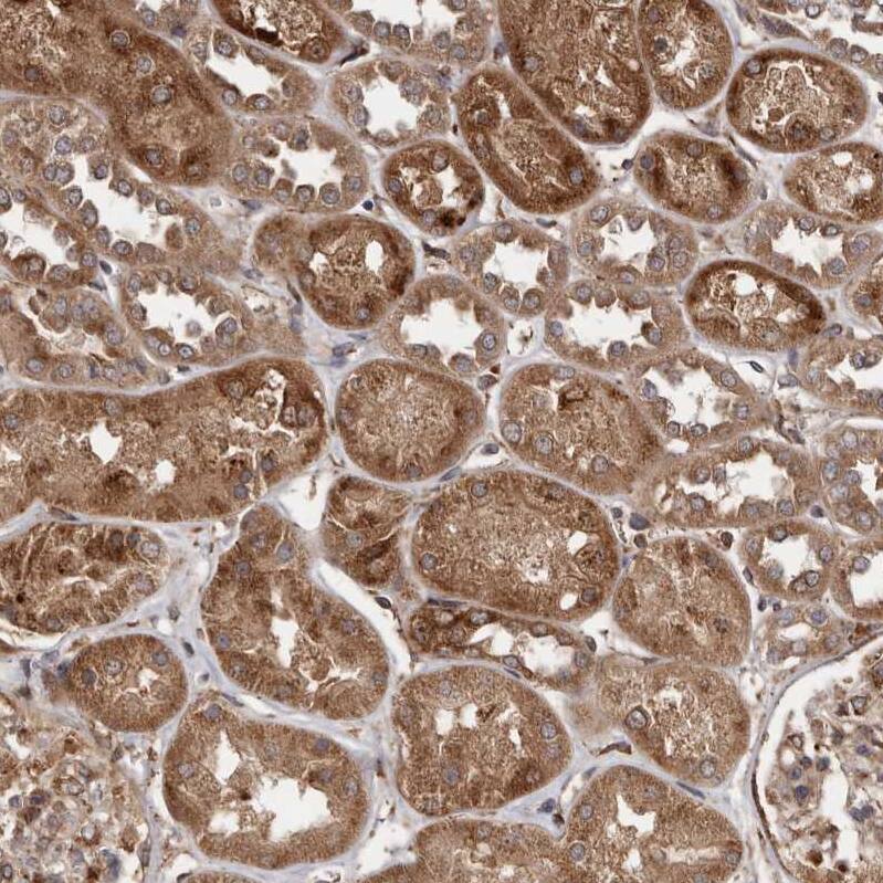 Staining of human kidney shows strong cytoplasmic positivity in cells in tubules.