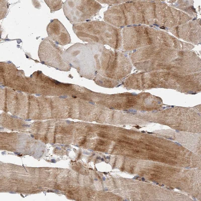 Staining of human skeletal muscle shows moderate cytoplasmic positivity in myocytes.