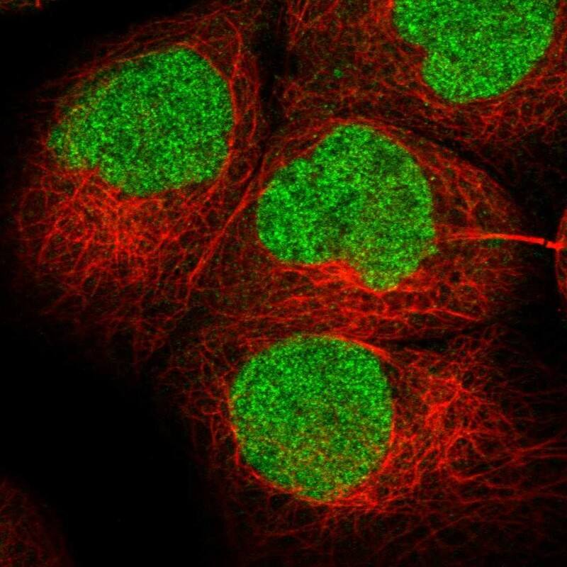 Staining of human cell line A-431 shows localization to nucleoplasm.