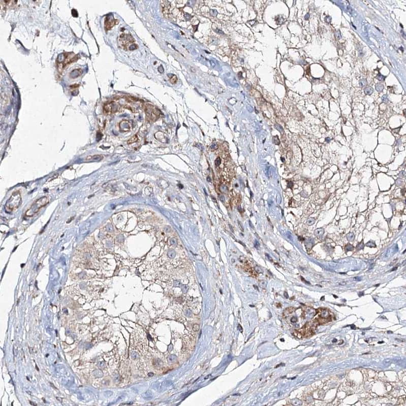 Immunohistochemistry-Paraffin FANCL Antibody - BSA Free