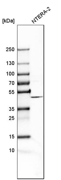 Analysis in human cell line NTERA-2.