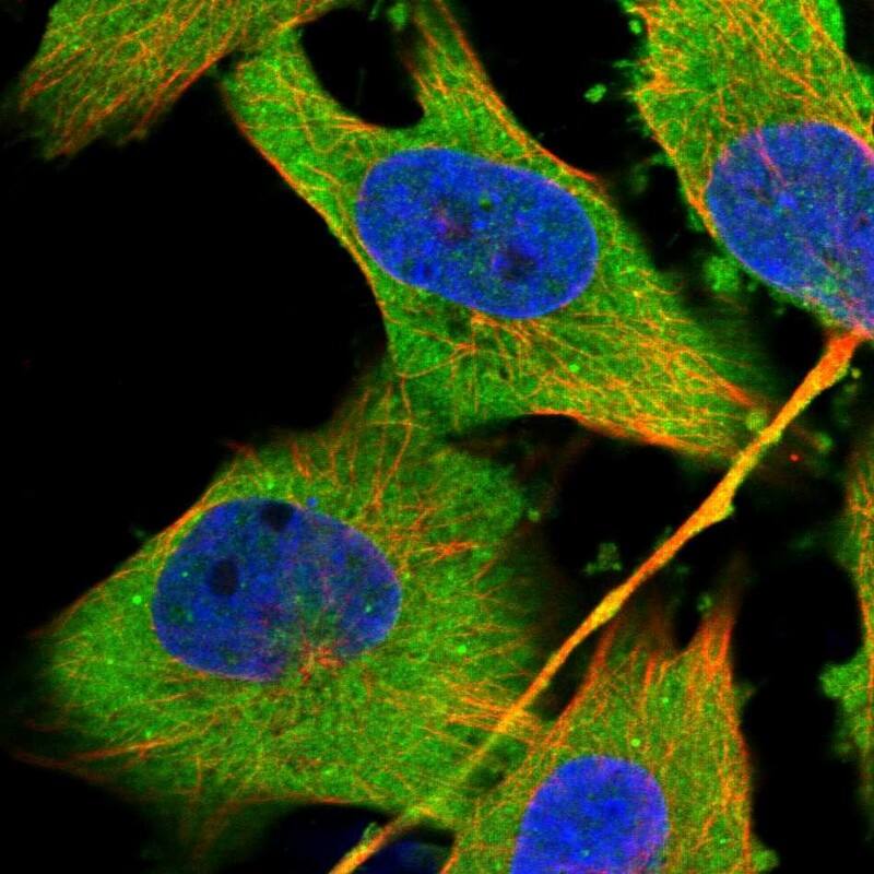 Staining of human cell line U-251 MG shows localization to cytosol.