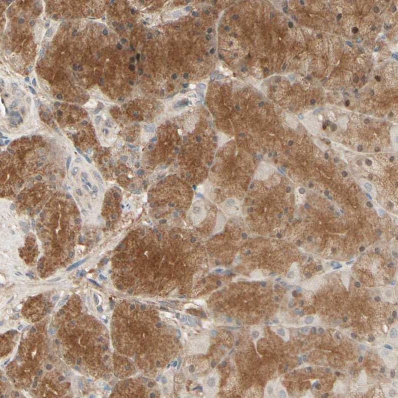 Staining of human stomach shows moderate cytoplasmic positivity in glandular cells.