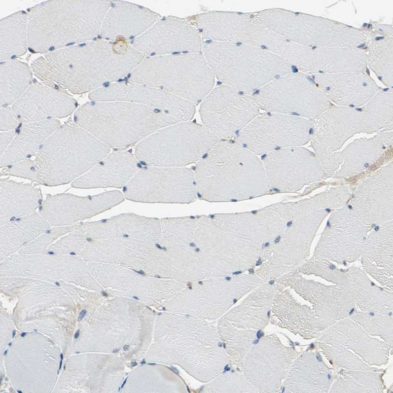 Staining of human skeletal muscle shows no positivity in myocytes.