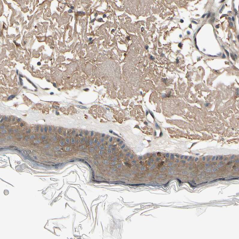 Staining of human skin shows moderate cytoplasmic positivity in squamous epithelial cells.