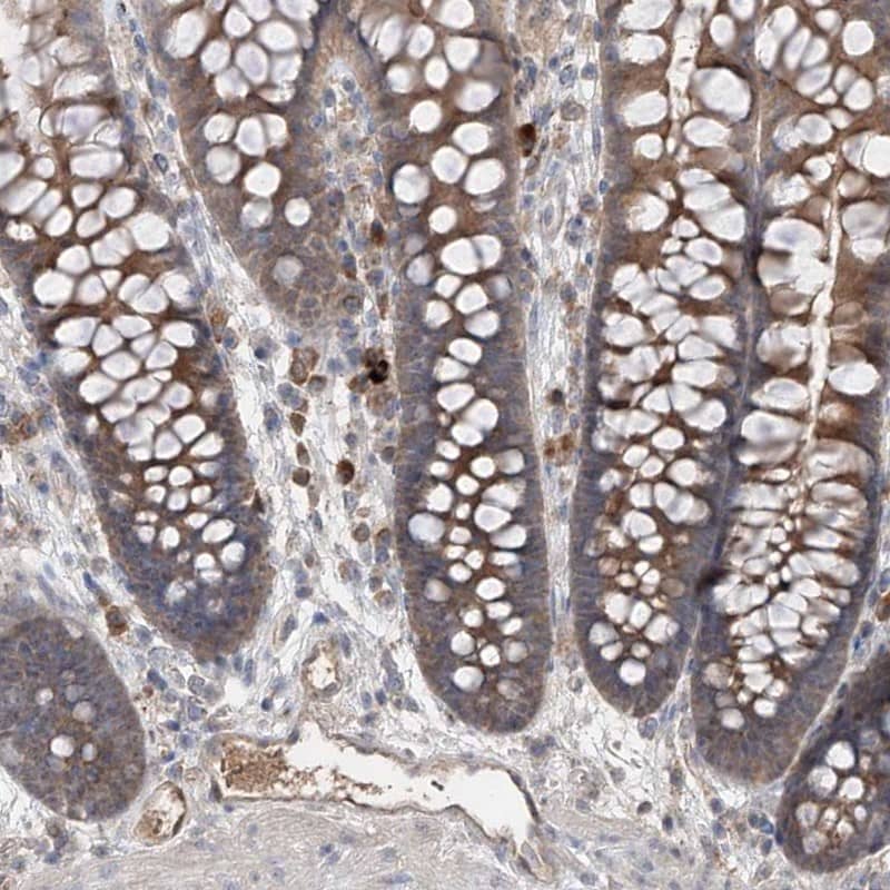 Staining of human colon shows moderate cytoplasmic positivity in glandular cells and endothelial cells.